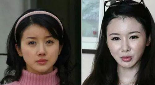 整容在线观看神马,揭秘整容在线观看背后的秘密与魅力 第2张 整容在线观看神马,揭秘整容在线观看背后的秘密与魅力 第2张
